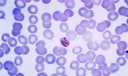 Plasmodium malariae